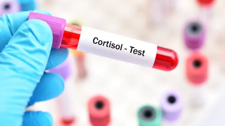 medir-el-cortisol-66fda55548424