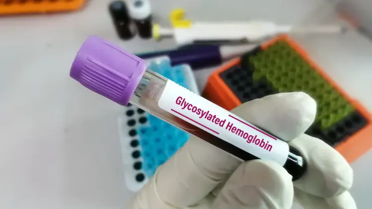 Tubo con sangre para prueba de hemoglobina glicosilada